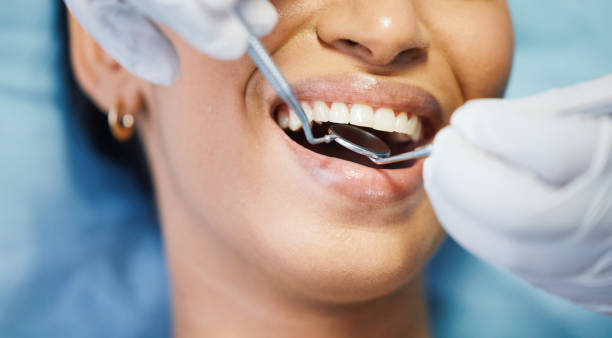 Best Emergency Denture Repair in Lynn, IN